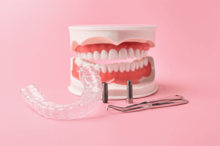 Are Dental Implants Considered Orthodontics Understanding the Key Differences and Overlap