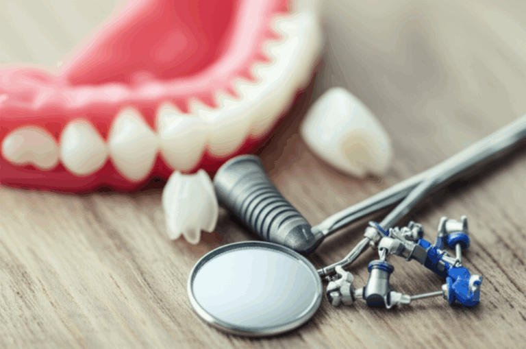 Are Dental Implants Covered by Health Insurance My Complete Guide to Coverage Costs
