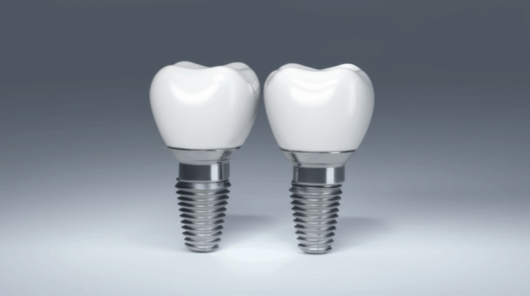 Are Dental Implants Covered by Medicaid Understanding Your Options for Tooth Replacement
