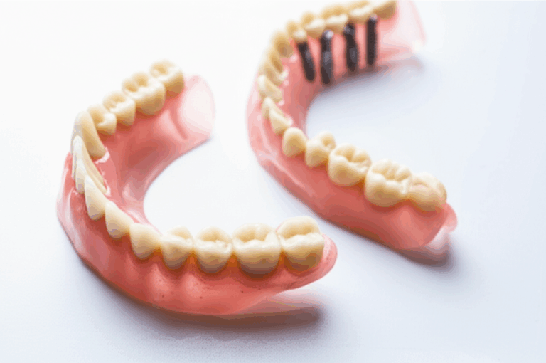 Are Dental Implants Dentures Understanding the Key Differences and Best Tooth Replacement Options