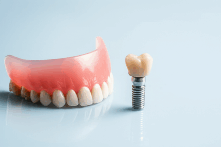 Are Dental Implants Medically Necessary Understanding When They Are Essential for Your Health