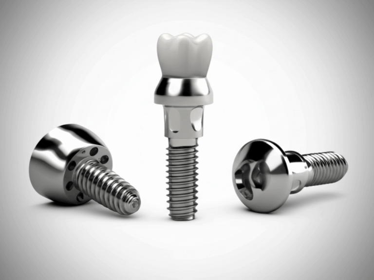 Are Dental Implants Metal The Simple Guide to Materials Safety and Smiling with Confidence