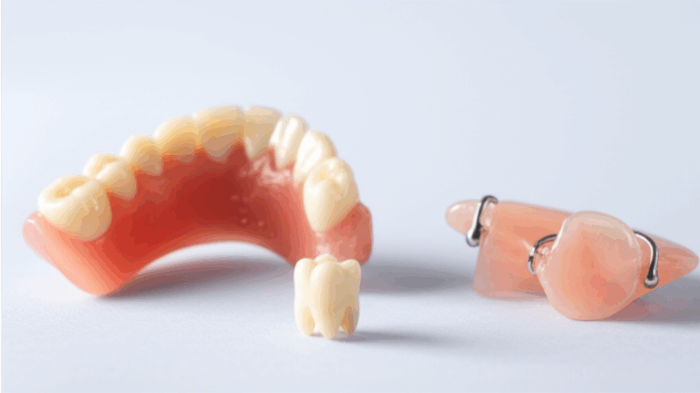 Are There Alternatives to Dental Implants Understanding Your Options