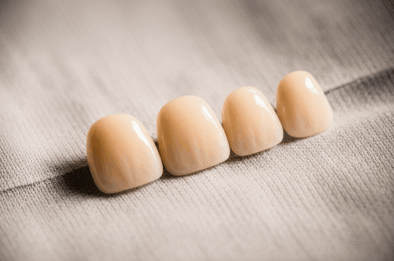 Are Veneers Removable The Truth About Dental Veneer Permanence
