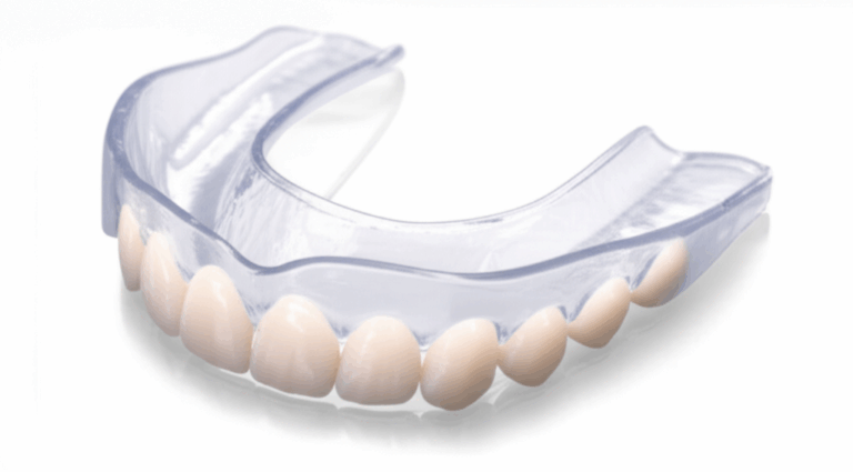Can You Wear a Mouthguard with Veneers Your Guide to Protecting Your Smile