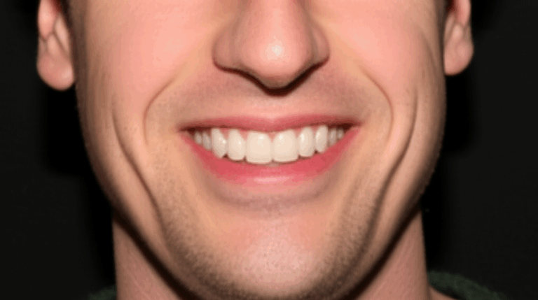 Did Andy Samberg Get Veneers Unpacking His Smile Transformation