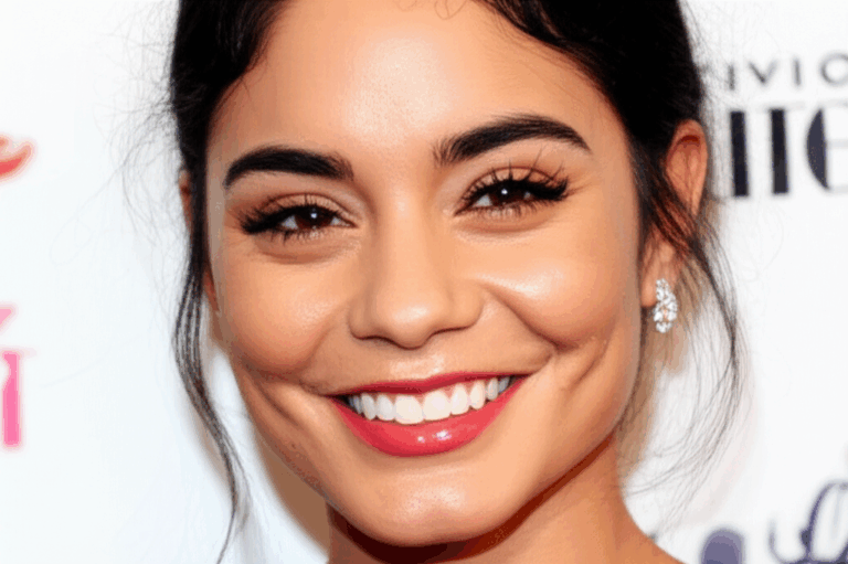 Did Vanessa Hudgens Get Veneers My Dive Into Her Smile Transformation
