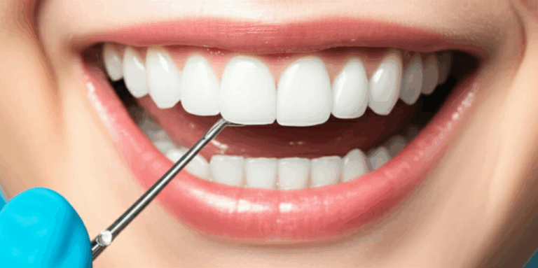 Do Dental Insurance Plans Cover Porcelain Veneers Unpacking Your Coverage Options