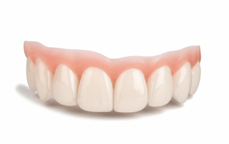 How Much Are Pop On Veneers Your Complete Cost Confidence Guide 2024