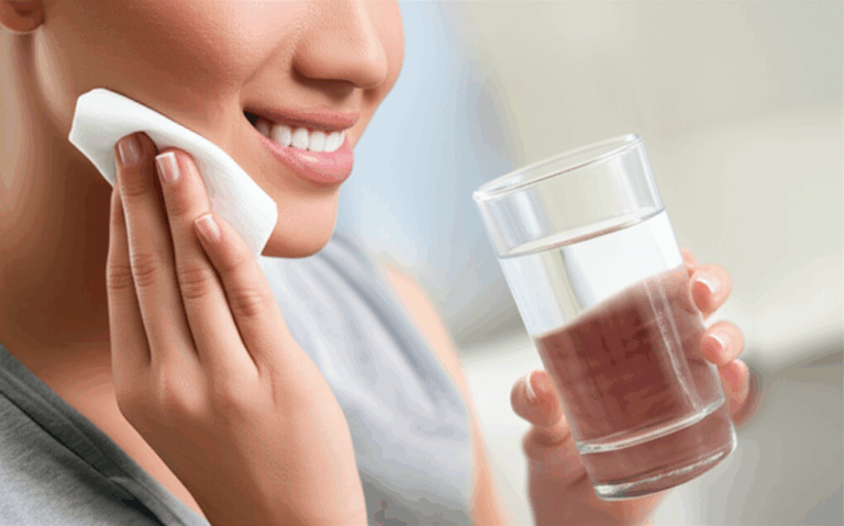 How to Ease Pain After Veneers Your Easy Guide to Comfort and Recovery